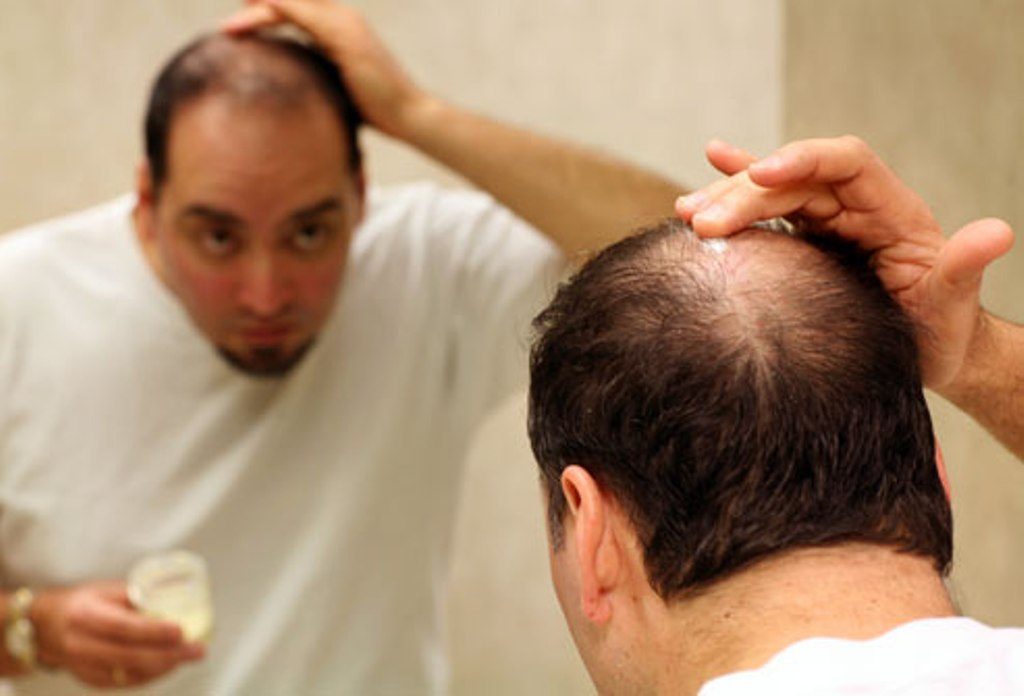 Know the Reason behind your Hairfall
