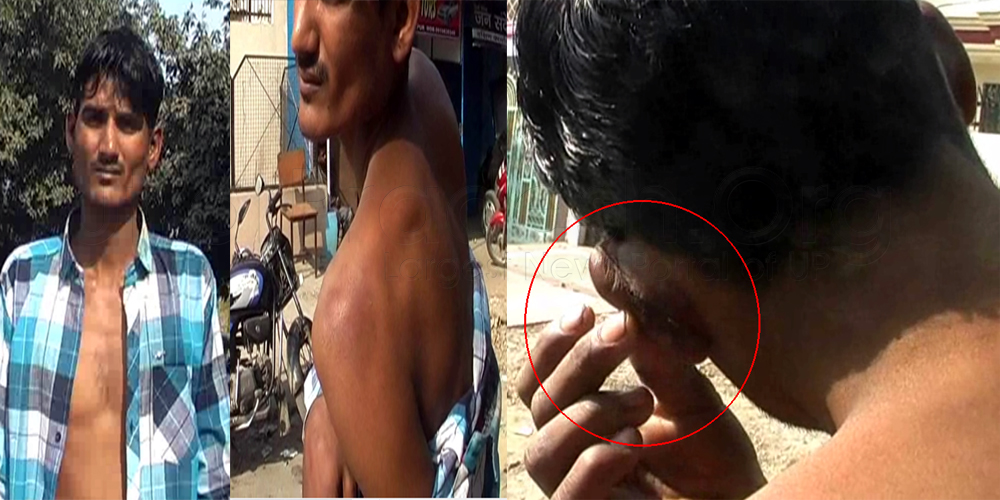 कानपुर पुलिस ने युवक को किया टार्चर