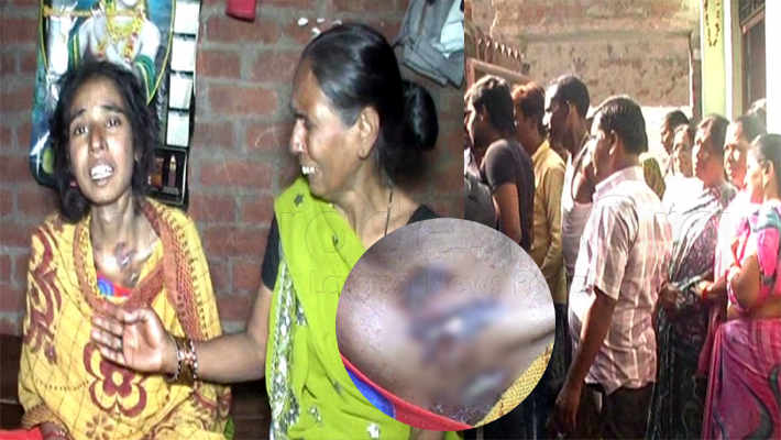 dowry harassment: woman burnt from boiled oil Forced Drink Urine