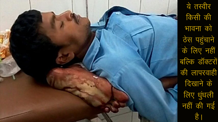 Jhansi Medical College doctors negligence: cut man leg and made pillow