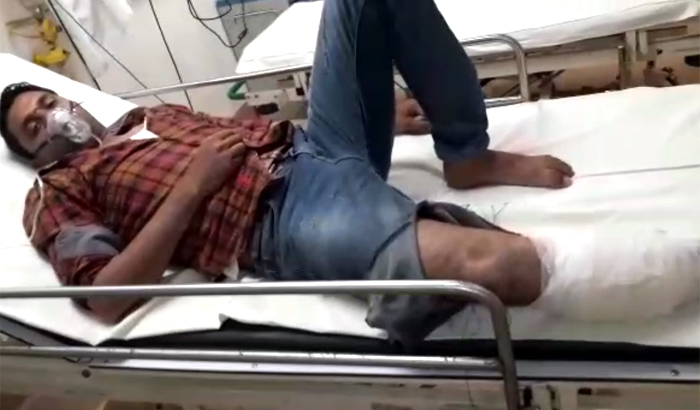goon injured in an police encounter in Ghaziabad District