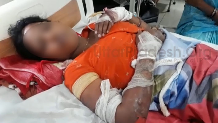 Gangrape victim attempted self-immolation