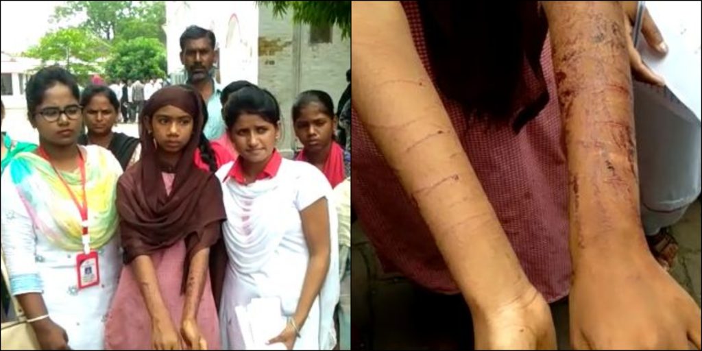 man beaten minor girl cut Hands and legs with blade