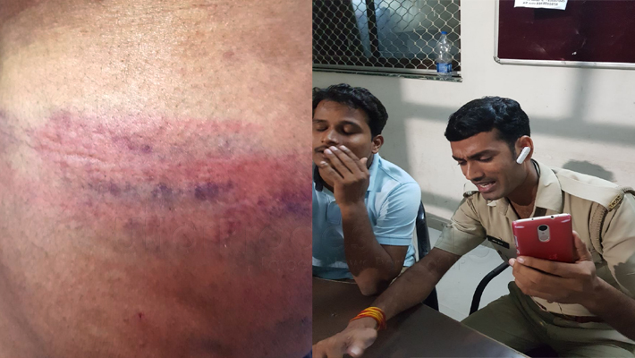 Lucknow: Police Cop Suspended for brutally beat to doctor Third degree torcher
