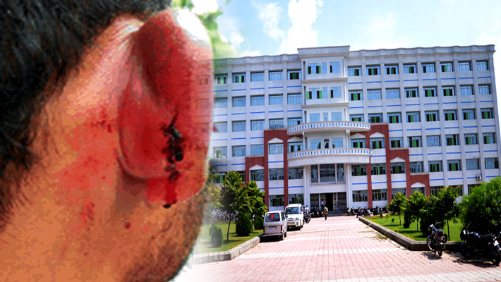 Students Injured in Firing on Domination in Integral University