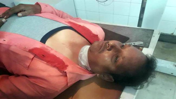 Firing at RSS Arms Worship Event Photographer Injured in Hathras