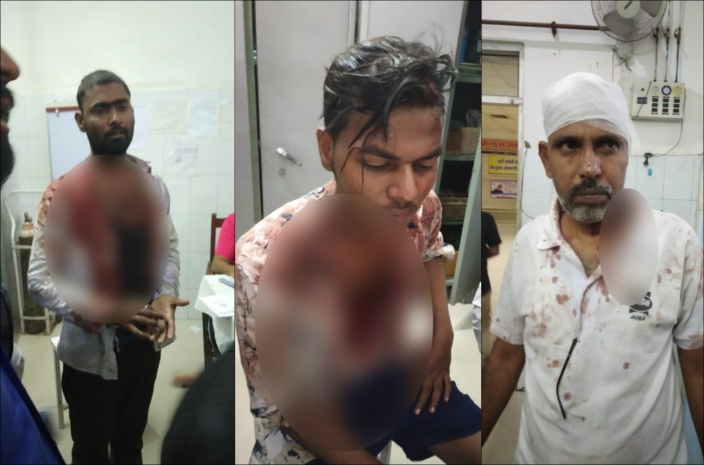 people fight over dogs stone pelting got injured in kanpur