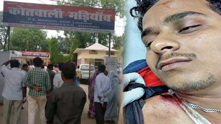 Man Shot FIR Filed in Madiyaon Police Station Lucknow