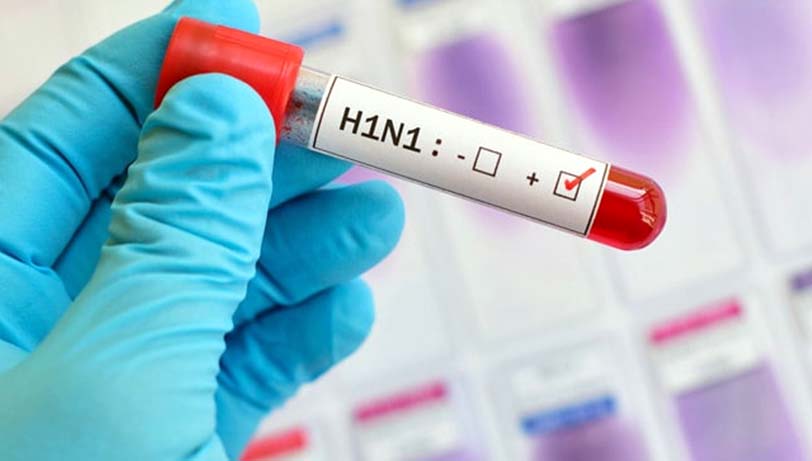 Swine Flu Eight New Patients with Resident Doctor Found in Lucknow