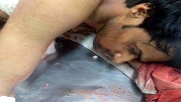 Tata Telco Employee Shot by Criminals in Gudamba Thana Lucknow